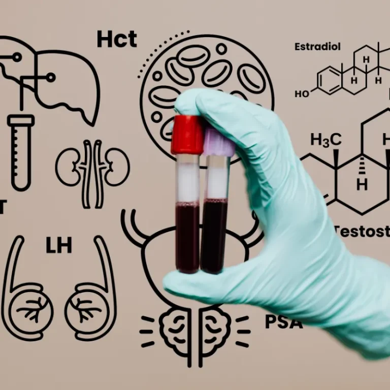 Gloved hand holding blood sample tubes surrounded by testosterone, estradiol, Hct, LH and PSA lab markers, showing why a total testosterone test alone is not enough before starting TRT