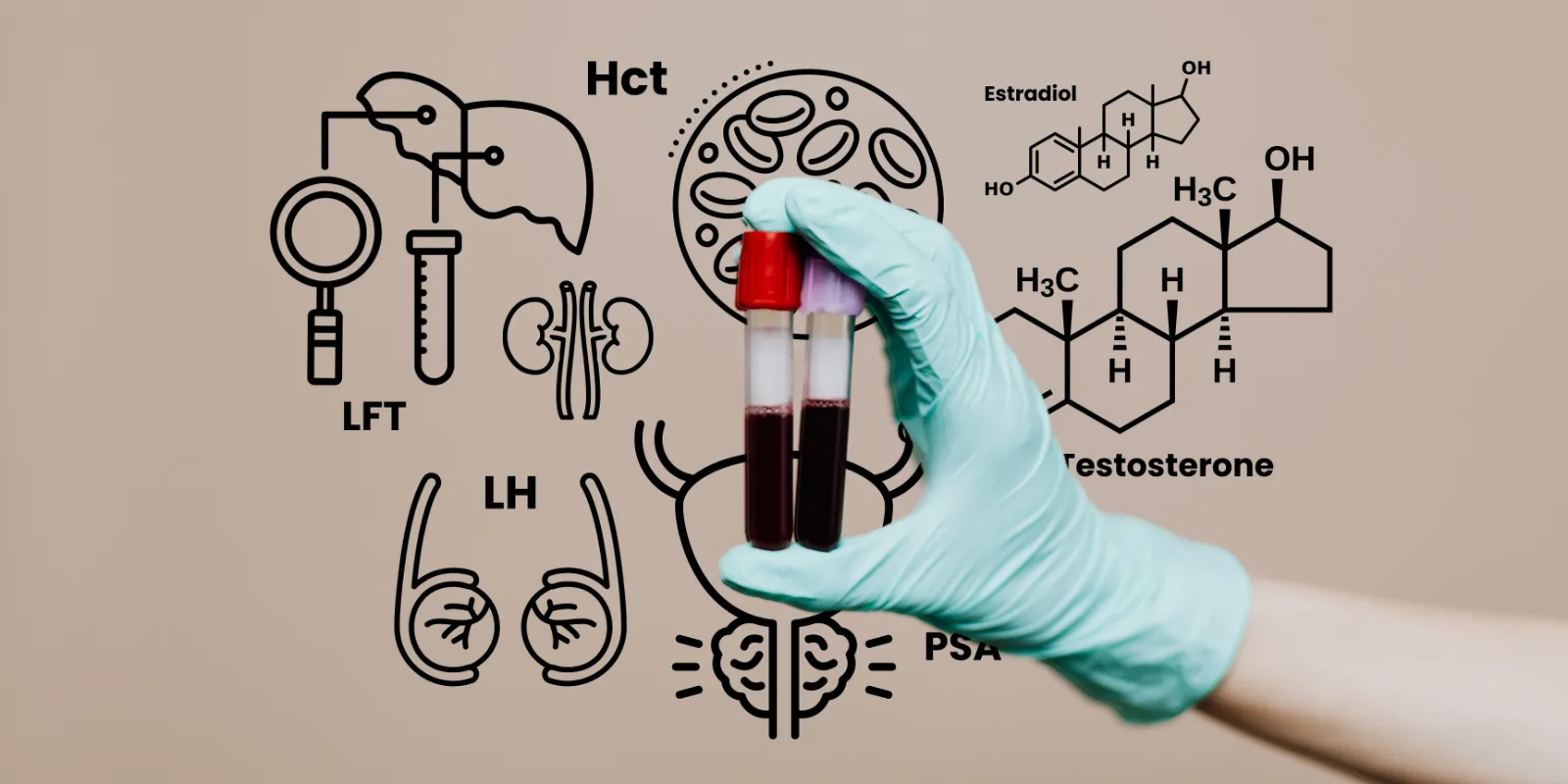 Blood tests before TRT Gloved hand holding blood sample tubes surrounded by testosterone, estradiol, Hct, LH and PSA lab markers, showing why a total testosterone test alone is not enough before starting TRT